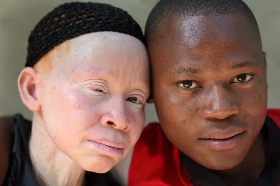 Skin Color and Intelligence: Why Correlation Isn’t Causation